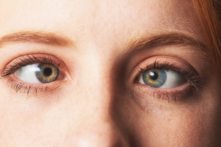 Gros plan sur les yeux d'une personne, montrant un œil avec une couleur verte et un autre avec une couleur bleue.