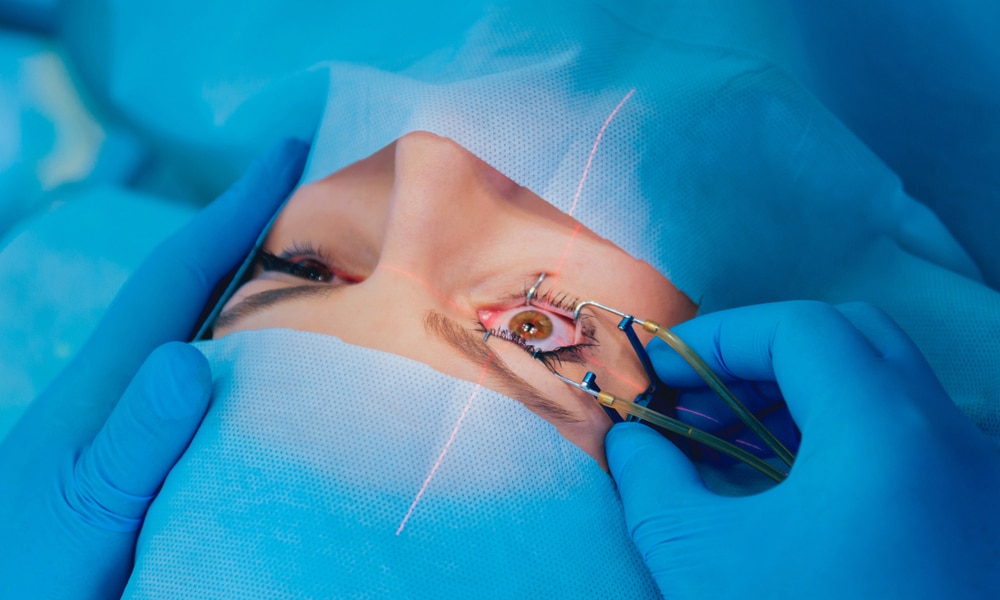 Close-up of an eye undergoing laser eye surgery, with medical tools and blue surgical drapes in the background.