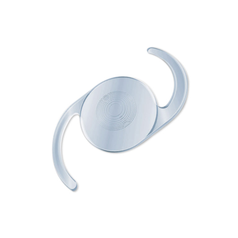Implant intraoculaire pour chirurgie de la cataracte, conçu pour remplacer le cristallin opacifié.