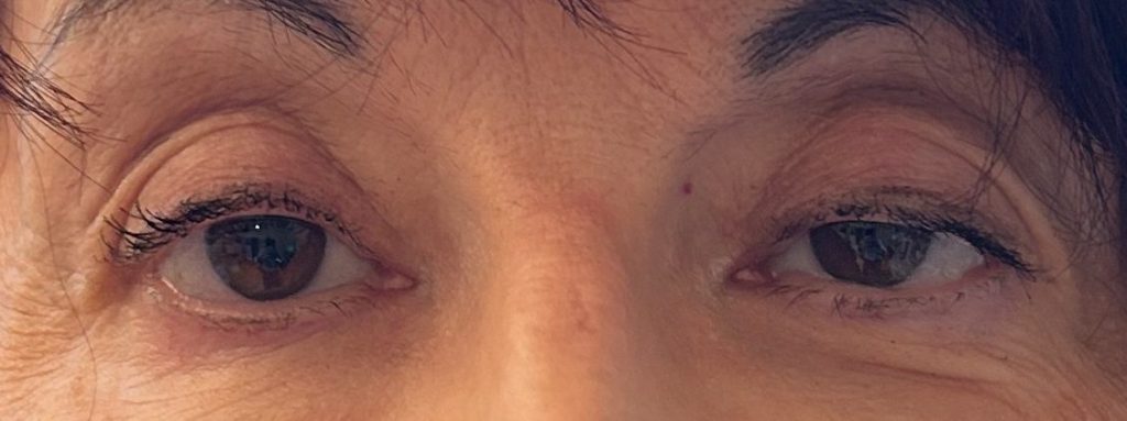 Gros plan sur les yeux d'une personne, montrant une paupière supérieure légèrement tombante et des cils naturels.