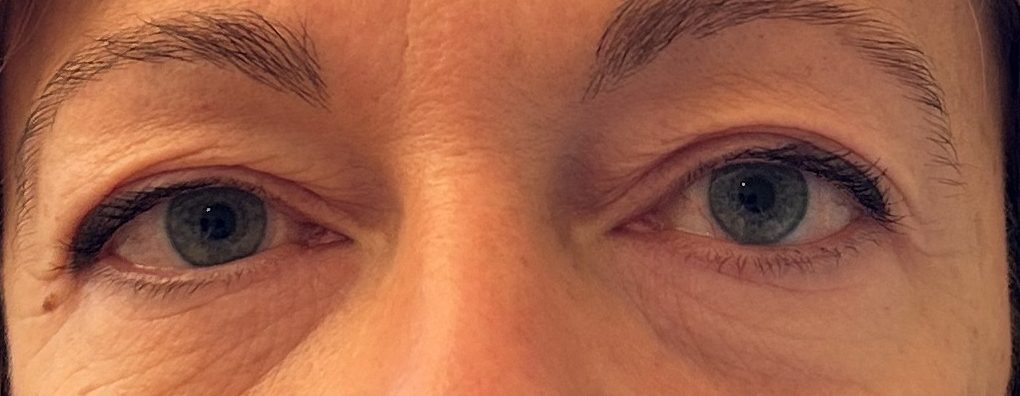 Gros plan des yeux d'une personne, montrant la peau autour des paupières et des signes de vieillissement.