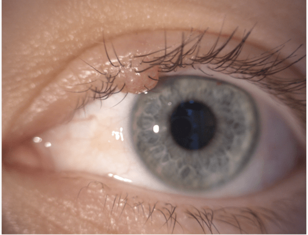 Gros plan sur un œil humain avec des cils bien définis et une iris de couleur claire.