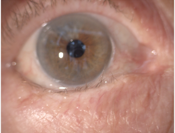 Gros plan sur un œil, montrant l'iris de couleur marron et des cils, avec des détails des contours de la paupière et de la peau environnante.